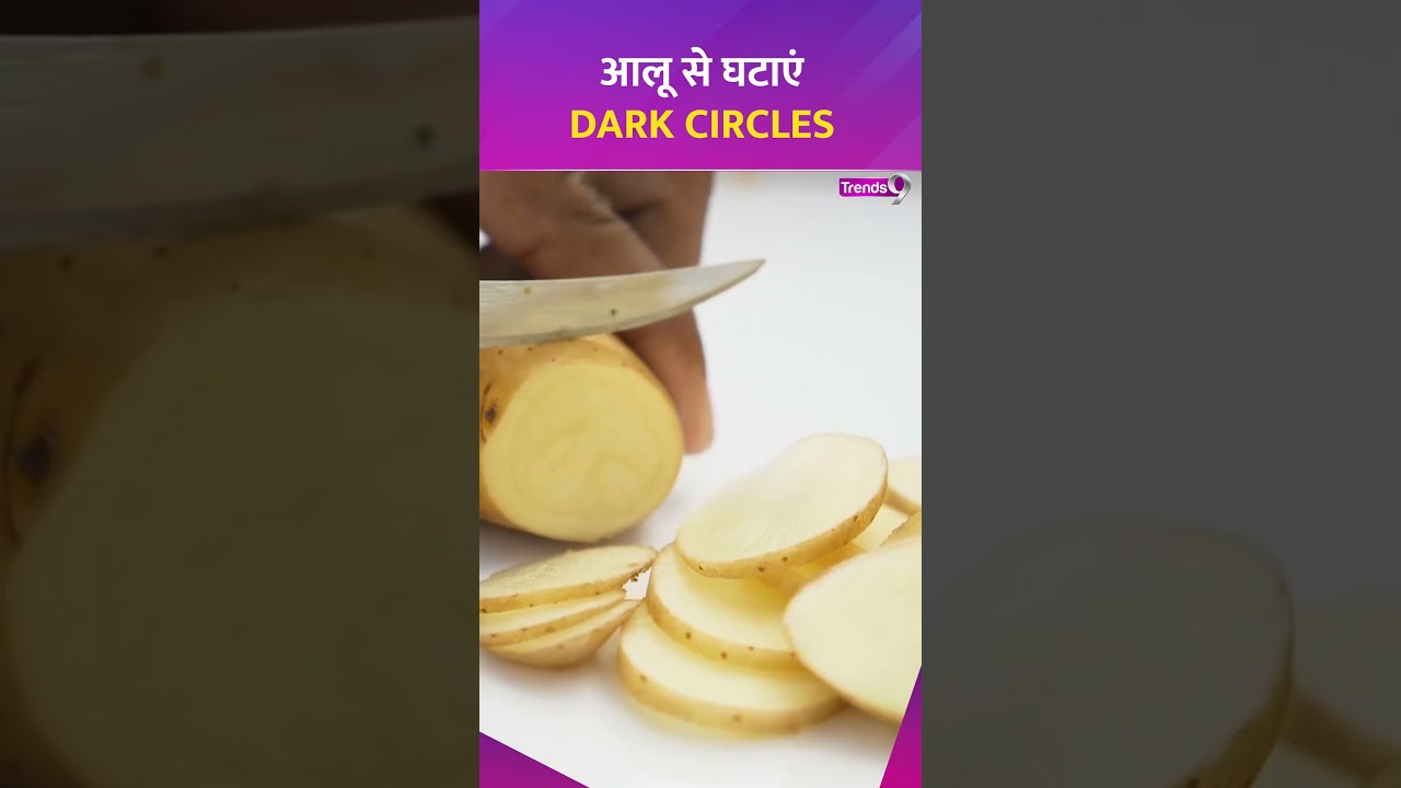 आलू से डार्क सर्कल कैसे हटाएं? आलू निखारेगा आपका रूप | Dark circles removing tips