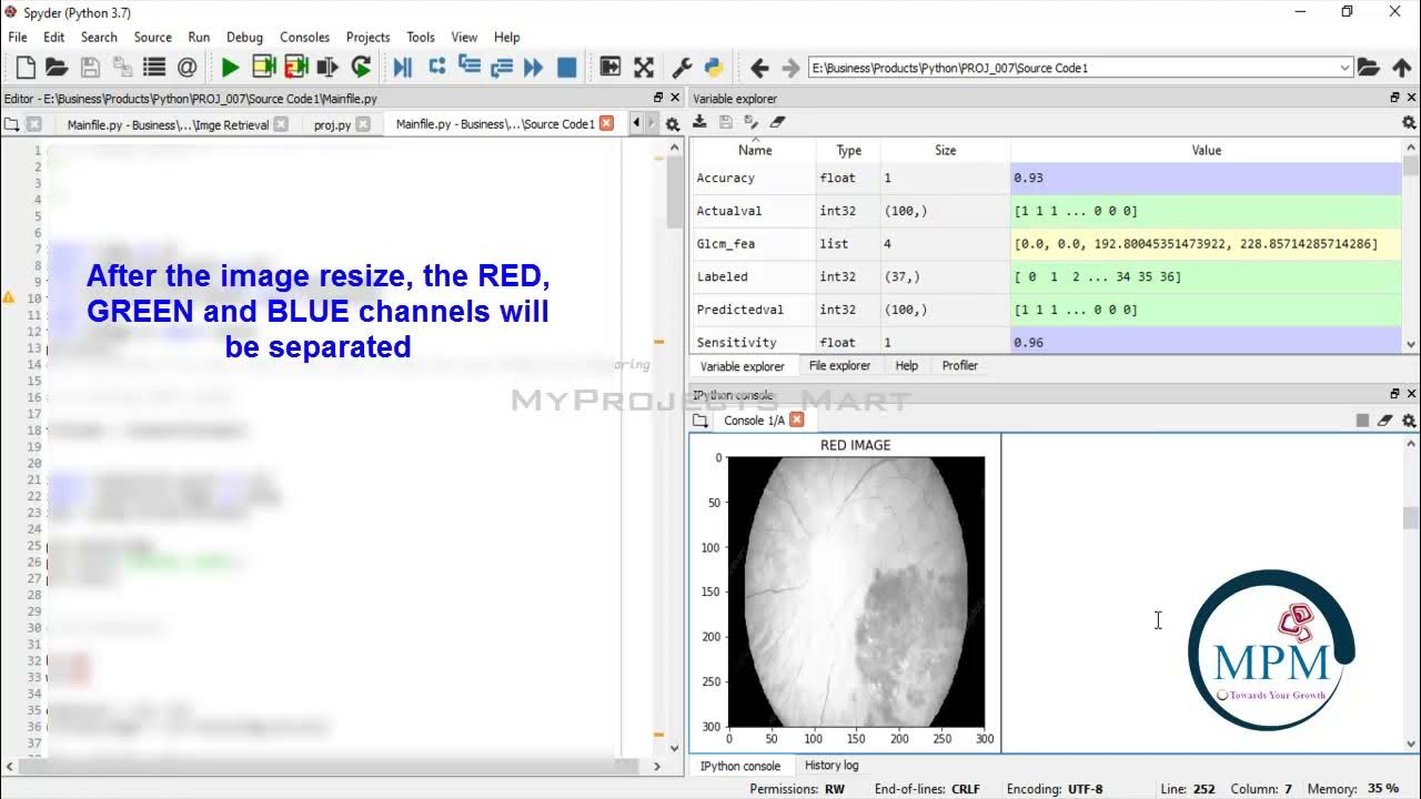 PYTHON 2021 Project - Segmentation and Classification of Diabetic ...