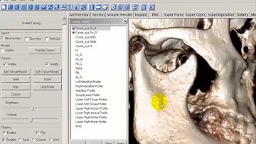 Tx STUDIO™: 3D Analysis Cephalometric Tracing