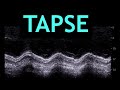 All about TAPSE! (Echocardiography)