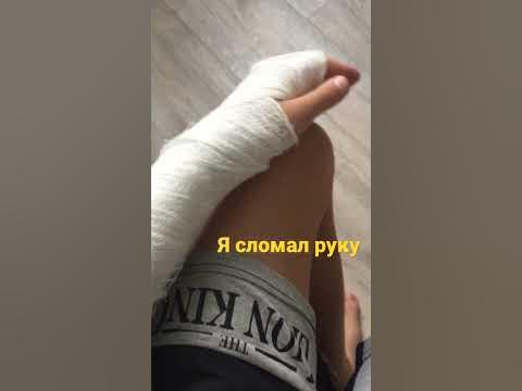 Сломал руку - YouTube