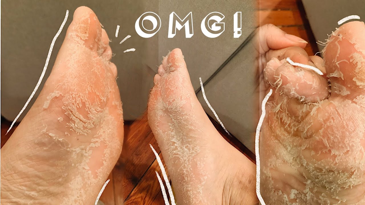 hver for sig deform bekæmpe QUARANTINE SELF CARE // Foot Peel Mask in Self Isolation DID IT WORK?!? -  YouTube