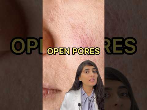 Video: Hvilken behandling er best for åpne porer?