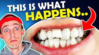 What happens if you DON'T WEAR YOUR RETAINER?? Orthodontist Explains