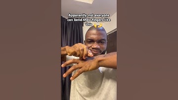 Who else can bend their fingers like mine😳 #foryou #finger #softbone #ffyl #funny #shorts