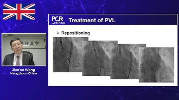 Transcatheter heart valve sizing in challenging aortic anatomies: experiences from Europe and China