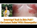 Rash in skin fold  intertrigo best homeopathic medicine for groin rash  toe rash  breast rash
