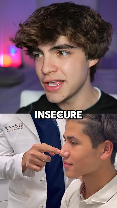 The most attractive nose shape for guys 😭