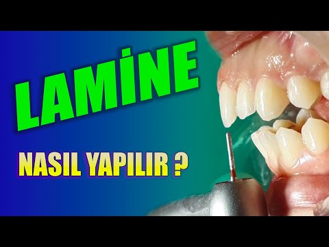 Video: Bir Belge Nasıl Lamine Edilir