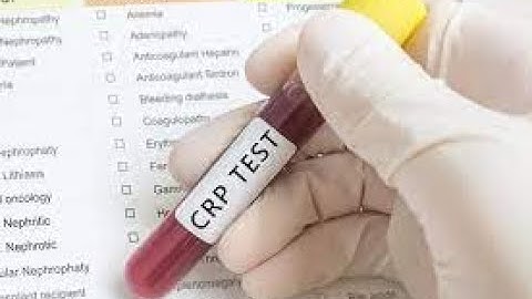 Pathology CPT codes Immunology Part 1 - simplify medical coding
