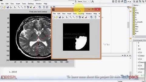 PDE Contour modal development for image segmentation in medical image processing (latest Project)