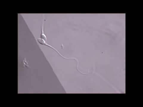 Sperm swimming in microscope field