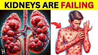 5 SIGNS Your Kidneys Are Crying For Help