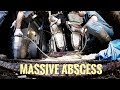 JUST A COW VET AND HIS GOPRO II: MASSIVE ABSCESS VLOG 174