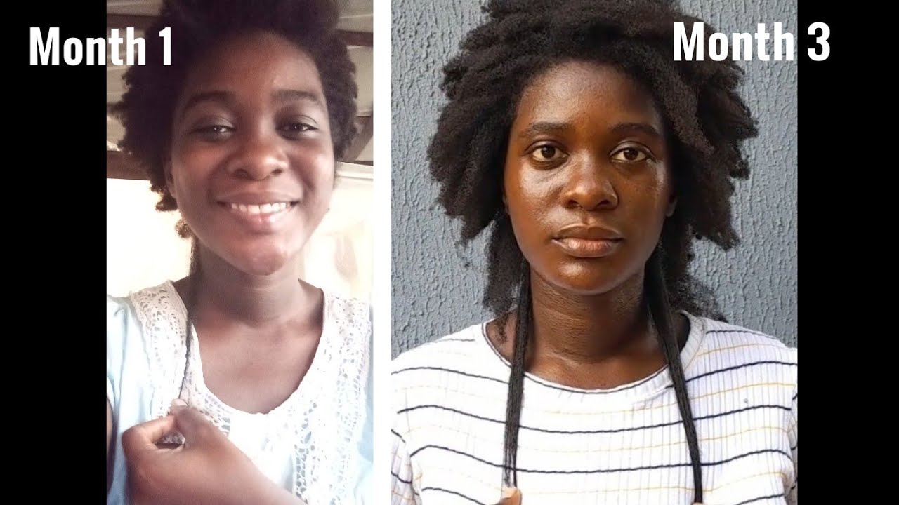 My Story: How I Stopped Hair Thinning & Thickened My 4c Hair Naturally