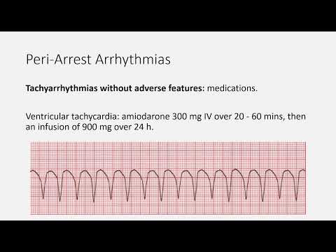 Cardiology Summary for MRCEM intermediate SBA