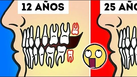 ¿Es normal tener 26 dientes?