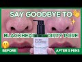 HOW TO: Some By Mi Bye Bye Blackhead 🌚 | 5 MINS ONLY!? | Pore Care | HIKOCO