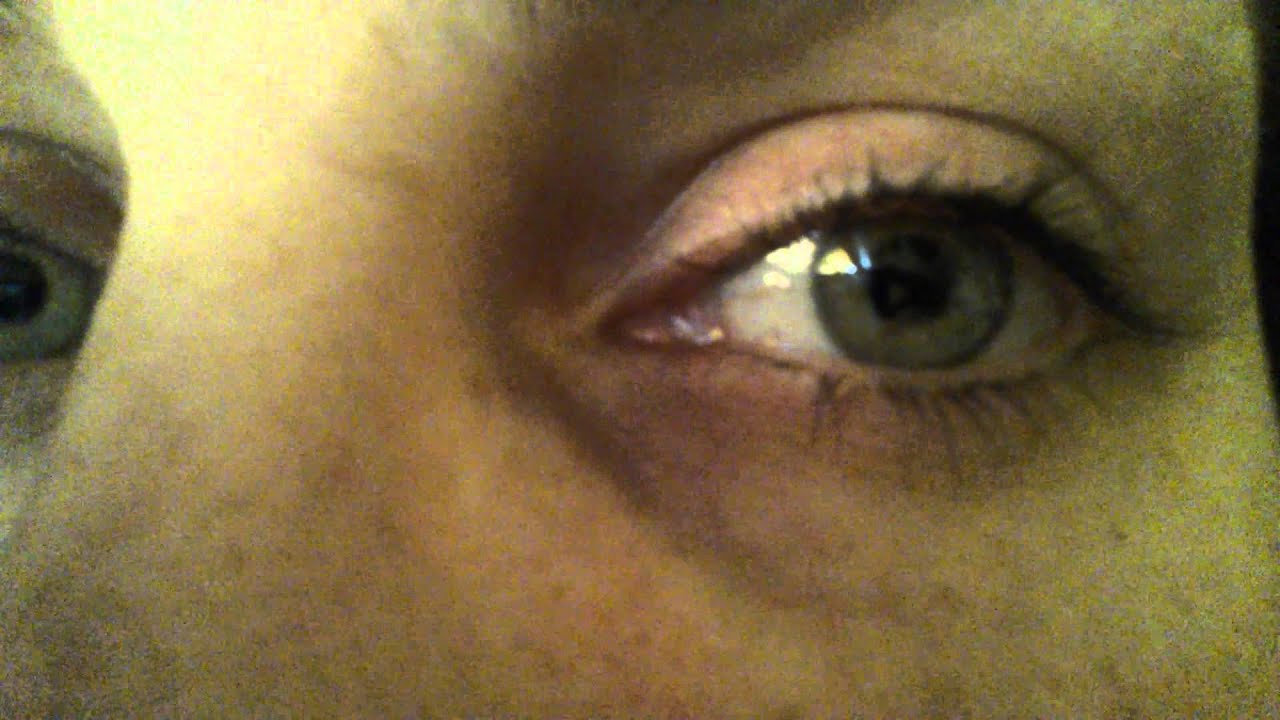 Twitching Eye Muscle Spasm - YouTube Twitching Eye Muscle Spasm - YouTube