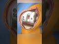 Knee Replacement