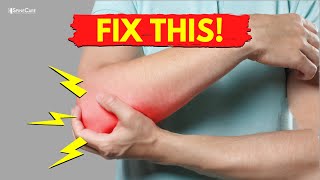 How to Fix Elbow Popping Sounds in 30 SECONDS