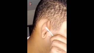 Never Clean Your Ear With Q Tips |😲😲| #shorts