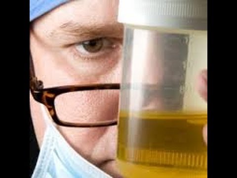 What can cause white blood cells to be in urine?