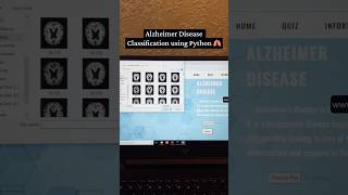Alzheimer Disease Prediction using Machine Learning 🫁🧑‍⚕️ #alzheimer #diseaseprediction #python