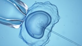 Infertility patients fear abortion bans could affect access to IVF