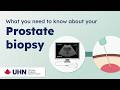 What you need to know about your prostate biopsy