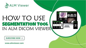 How to Use Segmentation Tool in ALM Dicom Viewer | By Alm Viewer