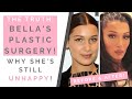 THE TRUTH ABOUT BELLA HADID'S PLASTIC SURGERY: What To Know About Fillers & Botox | Shallon