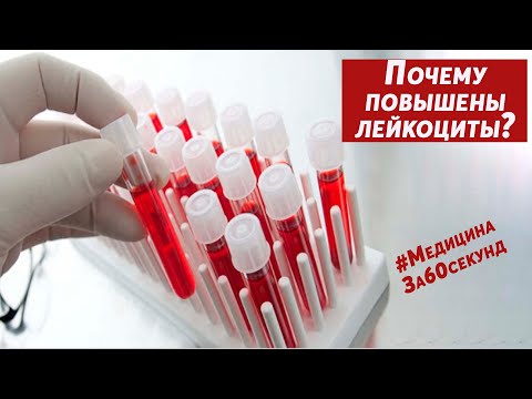 5 Причин высоких лейкоцитов в анализе крови | Почему повышены лейкоциты в анализе крови | Норма