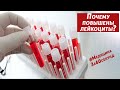 Высокие лейкоциты в анализе крови | Почему повышены лейкоциты в общем анализе крови |Лейкоциты норма