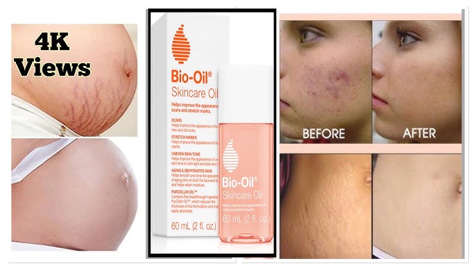 Introducing Bio-Oil® Dry Skin Gel 