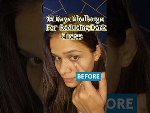 15 Day Under Eye Dark Circle Reduction Challenge With Potato Starch And Honey Shorts