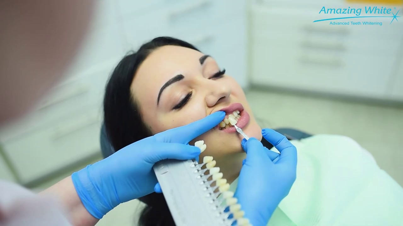 Системы отбеливания зубов Amazing White (США)