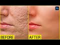 Face ko Smooth kaise kare | High - End Skin Retouching Photoshop Tutorial in Hindi | SABKE SAB