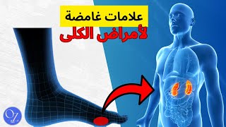 6 علامات تحذيرية: تدل أن الكلى لديك في خطر