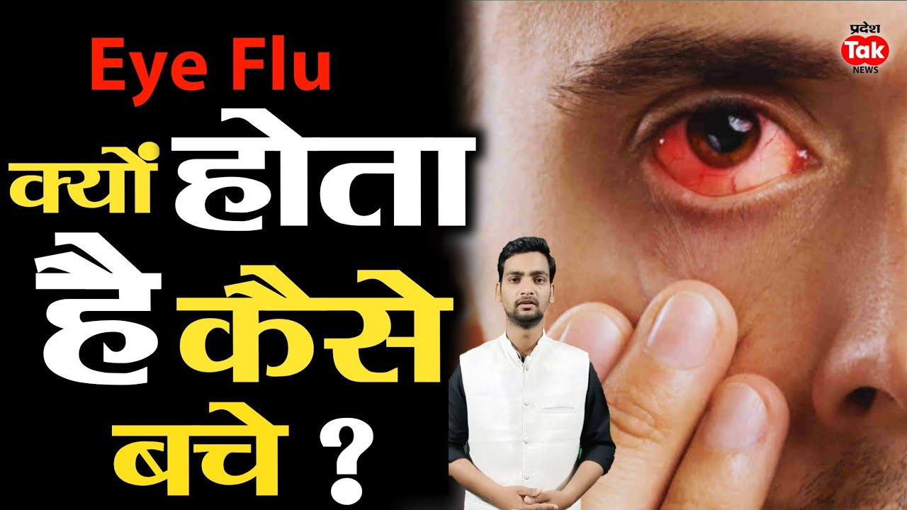 Eye Flu Eye flu hone par kya karen Eye flu kaise hota hai Eye flu Home treatment in hindi