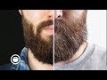 My Beard vs. Jeff Buoncristiano's