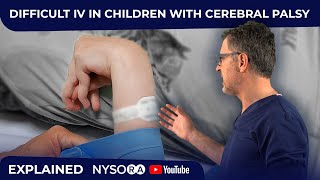 INTRAVENOUS CATHETER INSERTION IN CHILDREN WITH CEREBRAL PALSY