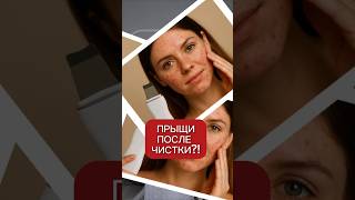 ПРЫЩИ после чистки #акне #прыщи #проблемнаякожа #чистка #чисткалица #умывание #аюна