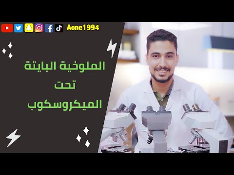 هل تحتوي الملوخية البايته علي ديدان ماسبب تدويد الملوخيه