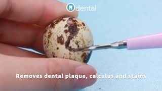 Odental - Ultrasonic Tooth Cleaner™