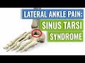 Sinus Tarsi Syndrome - One Cause of Lateral Ankle Pain