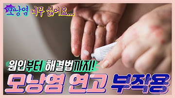 모낭염연고 부작용의 원인부터 해결법에 대한 모든 것 (ft. 무피로신)