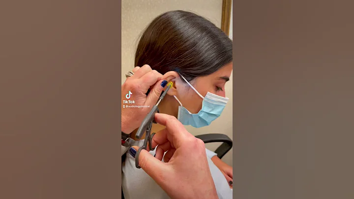Invisible hearing aid #lyric#audiology #audiologycentral - DayDayNews