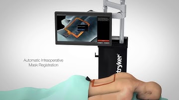 IBS Hospital | Navigation-Guided Spine Surgery | Precision with Stryker’s Advanced Technology
