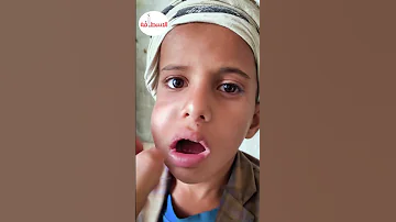 ما هوه نبات القات الأكثر انتشارا في اليمن 